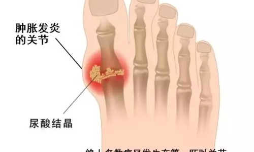 als能治好吗-权威als病人能活多久平台,分享专业als能治好吗知识_als病人可以解冻吗网